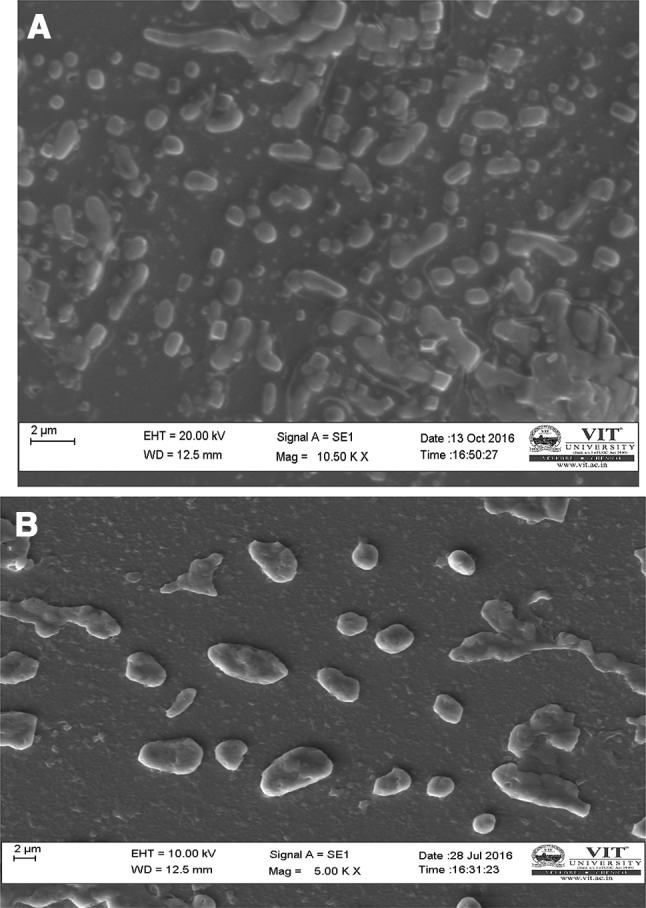 Simple isolation and characterization of seminal plasma extracellular vesicle and its total RNA in an academic lab.